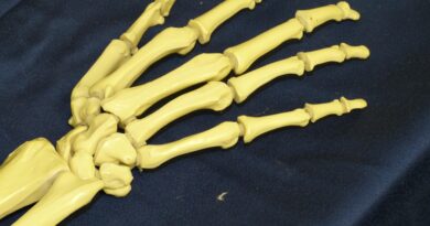 Božićni kaktus i prirodni recepti za jačanje kostiju: med, susam, smokve i limun