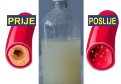 Začepljenje arterija: šta je, kako nastaje i kako prirodnim putem podržati zdravlje krvnih sudova