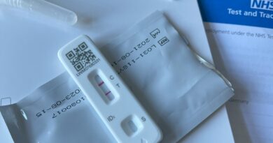 Maca Diskrecija želi DNK test: Dugogodišnje spekulacije o očinstvu ponovo u centru pažnje
