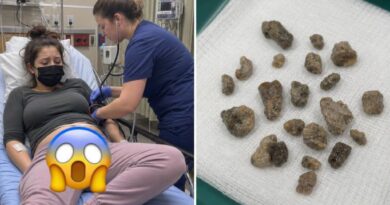OSOBA HITNO PREVEZENA U BOLNICU NAKON RIZIČNOG POSTUPKA: Lekari otkrili povrede koje su zahtevale specijalizovanu pomoć