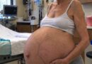 Margaret je u 61. godini postala majka: Pregled tokom trudnoće otkrio je promenu na bubregu