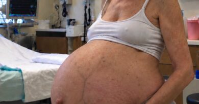 Margaret je u 61. godini postala majka: Pregled tokom trudnoće otkrio je promenu na bubregu