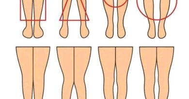 Ravne, O ili X noge: Šta njihov oblik može da pokaže, a šta ne?
