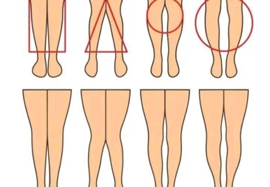 Ravne, O ili X noge: Šta njihov oblik može da pokaže, a šta ne?