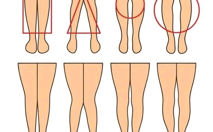 Ravne, O ili X noge: Šta njihov oblik može da pokaže, a šta ne?