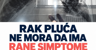 Dugotrajan umor nije uvek posledica stresa: Kada je važno otići na pregled